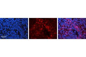 Immunohistochemistry (IHC) image for anti-Heat Shock Protein 90kDa alpha (Cytosolic), Class A Member 1 (HSP90AA1) (N-Term) antibody (ABIN2779296)