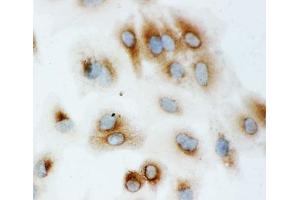 ICC testing of HSP70 antibody and A549 cells (HSP70 antibody  (AA 577-596))