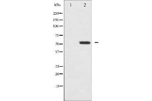 Western blot analysis of HNF4 alpha phosphorylation expression in EGF treated HuvEc whole cell lysates,The lane on the left is treated with the antigen-specific peptide. (HNF4A antibody  (pSer313))