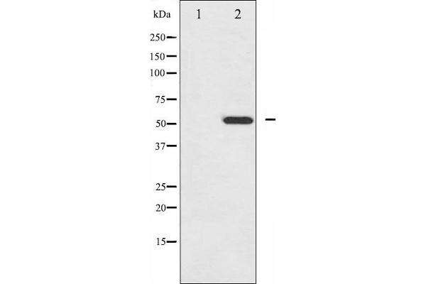 HNF4A Antikörper  (pSer313)