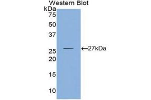 Western blot analysis of the recombinant protein. (CAMKII gamma antibody  (AA 75-281))