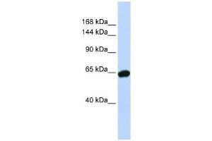 Western Blot showing ZNF91 antibody used at a concentration of 1-2 ug/ml to detect its target protein. (ZFP91 antibody  (N-Term))