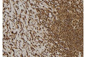 ABIN6276293 at 1/100 staining Human gastric tissue by IHC-P. (BCL2L1 antibody  (N-Term))