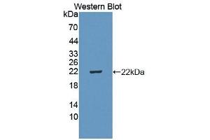 Detection of Recombinant IL5Ra, Mouse using Polyclonal Antibody to Interleukin 5 Receptor Alpha (IL5Ra) (IL5RA antibody  (AA 41-203))