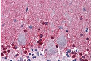 Human Brain, Cerebellum: Formalin-Fixed, Paraffin-Embedded (FFPE) (CBS antibody  (AA 1-101))