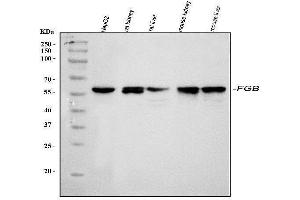Western blot analysis of Fibrinogen beta chain/FGB using anti-Fibrinogen beta chain/FGB antibody (ABIN4886579).