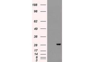 HEK293T cells were transfected with the pCMV6-ENTRY control (Left lane) or pCMV6-ENTRY BFGF (Right lane) cDNA for 48 hrs and lysed. (FGF2 antibody  (AA 10-155))