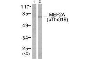 Western blot analysis of extracts from K562 cells treated with UV 15', using MEF2A (Phospho-Thr319) Antibody. (MEF2A antibody  (pThr319))