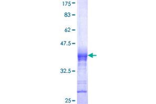 CACNB2 Protein (AA 213-301) (GST tag)