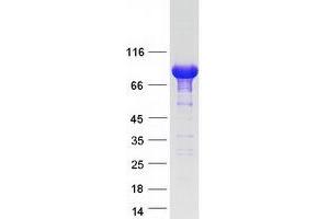 Sterile alpha Motif Domain Containing 4B (SAMD4B) protein (Myc-DYKDDDDK Tag)