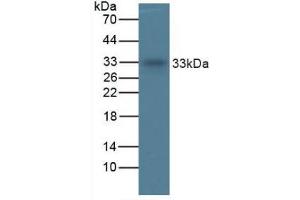 Figure. (TPSAB1 antibody  (AA 161-262))
