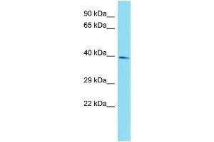 Host: Rabbit Target Name: RBMXL1 Sample Type: HepG2 Whole Cell lysates Antibody Dilution: 1. (RBMXL1 antibody  (Middle Region))