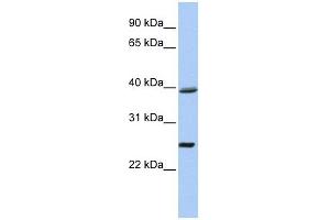 C12ORF42 antibody used at 1 ug/ml to detect target protein. (C12orf42 antibody  (N-Term))