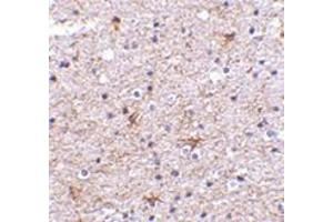 Immunohistochemistry of TMP21 in human brain tissue with this product at 2. (TMED10 antibody  (C-Term))