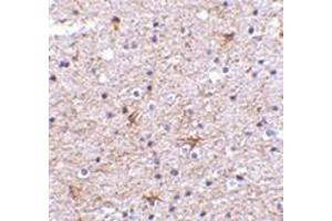 Immunohistochemistry of TMP21 in human brain tissue with this product at 2. (TMED10 antibody  (C-Term))