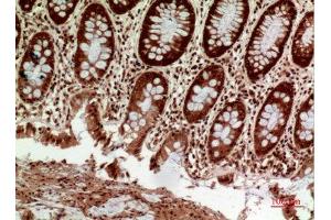 Immunohistochemistry (IHC) analysis of paraffin-embedded Human Colon, antibody was diluted at 1:100. (HLA-DQ1/DQ2 antibody  (Internal Region))