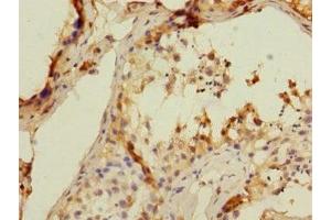 Immunohistochemistry of paraffin-embedded human testis tissue using ABIN7171407 at dilution of 1:100 (CD8B antibody  (AA 22-170))