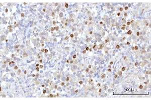IHC analysis of RRP7A using anti-RRP7A antibody (ABIN7599044). (RRP7A antibody  (AA 1-181))