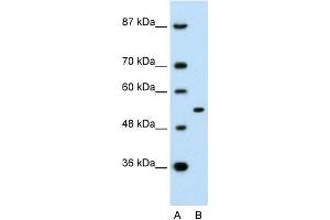 WB Suggested Anti-APBA1 Antibody Titration:  0. (APBA1 antibody  (N-Term))