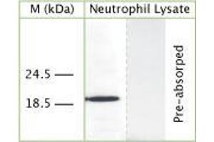 WB on human neutrophil lysate using Rabbit antibody to human Cathelicidin antimicrobial peptide (CAP-18, antibacterial protein LL-37, CAMP, CRAMP, FALL39): IgG (ABIN350184) at 50 µg/ml concentration. (Cathelicidin antibody)