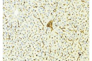 ABIN6275808 at 1/100 staining Mouse liver tissue by IHC-P.
