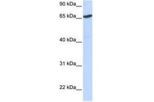 Image no. 1 for anti-L(3)mbt-Like 1 (L3MBTL1) (AA 144-193) antibody (ABIN6742622)