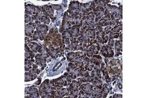 Immunohistochemical staining of human pancreas with FKBP9 polyclonal antibody  shows strong cytoplasmic positivity in exocrine glandular cells at 1:50-1:200 dilution. (FKBP9 antibody)