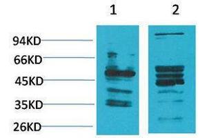 Western Blotting (WB) image for anti-Neuromedin B Receptor (NMBR) antibody (ABIN3181543) (NMBR antibody)