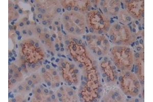 Detection of Cys-C in Mouse Kidney Tissue using Polyclonal Antibody to Cystatin C (Cys-C) (CST3 antibody  (AA 21-140))