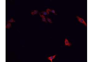 ABIN6266732 staining A-431 cells by IF/ICC. (PTTG1 antibody  (Internal Region))