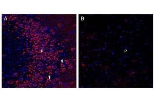 Expression of Neuronal Pentraxin Receptor in rat hippocampus. (Neuronal Pentraxin Receptor (NPTXR) Peptide)