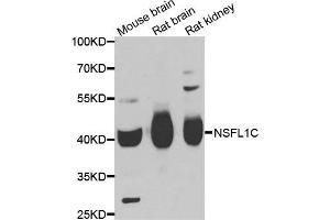 Western blot analysis of extracts of various cell lines, using NSFL1C antibody. (NSFL1C antibody)