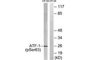 Western blot analysis of extracts from HT29 cells treated with Insulin 0. (AFT1 antibody  (pSer63))