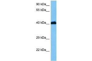 Host:  Mouse  Target Name:  HMBOX1  Sample Tissue:  Mouse Brain  Antibody Dilution:  1ug/ml (HMBOX1 antibody  (N-Term))