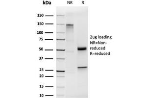 SDS-PAGE Analysis of Purified Cytokeratin 19 Rabbit Recombinant Monoclonal Antibody (KRT19/1959R). (Recombinant Cytokeratin 19 antibody)