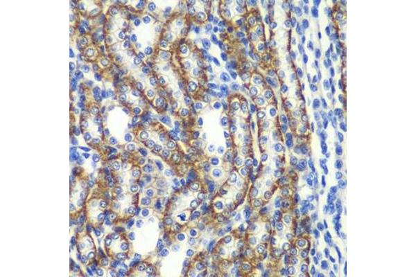 ZFAND3 antibody  (AA 1-227)