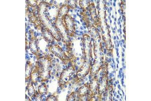 Immunohistochemistry of paraffin-embedded rat kidney using ZF antibody (ABIN6130814, ABIN6150426, ABIN6150427 and ABIN6223369) at dilution of 1:100 (40x lens). (ZFAND3 antibody  (AA 1-227))
