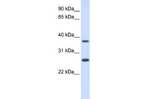 WB Suggested Anti-FAM156A Antibody Titration:  0. (FAM156A antibody  (N-Term))