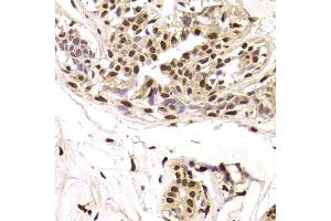 Immunohistochemistry of paraffin-embedded human breast using SNRPA Antibody.