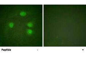 Immunofluorescence analysis of HeLa cells, using KCNJ3 polyclonal antibody . (KCNJ3 antibody  (Ser185))