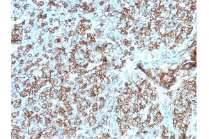 Formalin-fixed, paraffin-embedded human Tonsil stained with HLA- Pan Mouse Monoclonal Antibody (CR3/43). (MHC Class II HLA-DP/DQ/DR antibody)