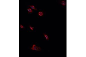 ABIN6276806 staining HepG2? (Decorin antibody  (Internal Region))