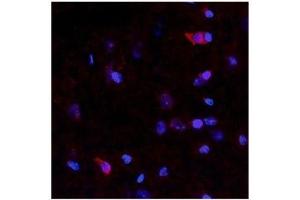 Netrin 4 antibody used at a concentration of 10 ug/ml to detect neurons and epithelial cells in rodent brain (red). (Netrin 4 antibody  (N-Term))