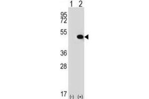 Western Blotting (WB) image for anti-Thyroid Hormone Receptor Interactor 13 (TRIP13) antibody (ABIN2996863)