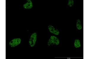 Immunofluorescence of monoclonal antibody to PLCB2 on HeLa cell. (Phospholipase C beta 2 antibody  (AA 1-199))