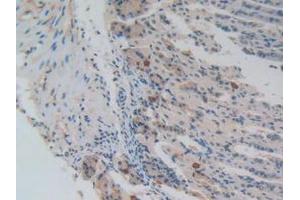IHC-P analysis of Mouse Stomach Tissue, with DAB staining. (NUP85 antibody  (AA 418-653))