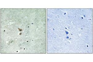 Immunohistochemistry analysis of paraffin-embedded human brain tissue using RIPK2 (Phospho-Ser176) antibody. (RIPK2 antibody  (pSer176))