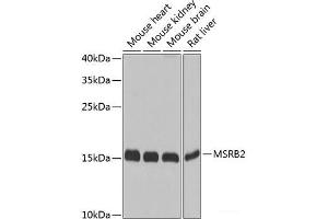 Western blot analysis of extracts of various cell lines using MSRB2 Polyclonal Antibody at dilution of 1:1000. (MSRB2 antibody)