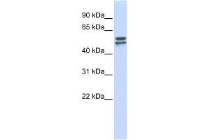 G6PD antibody used at 1 ug/ml to detect target protein. (Glucose-6-Phosphate Dehydrogenase antibody  (Middle Region))