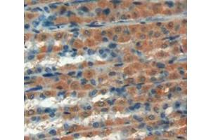 Figure. (GREM1 antibody  (AA 26-184))